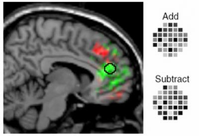 Brain Scan
