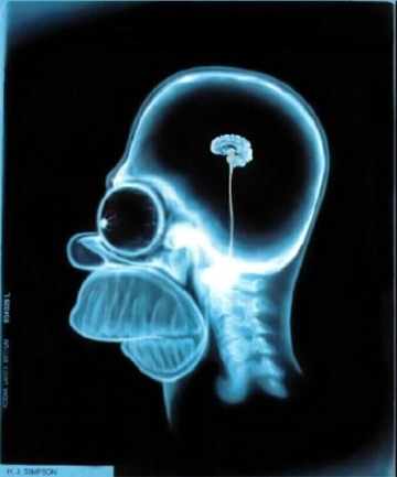 Une IRM du cerveau d