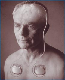 Medtronic