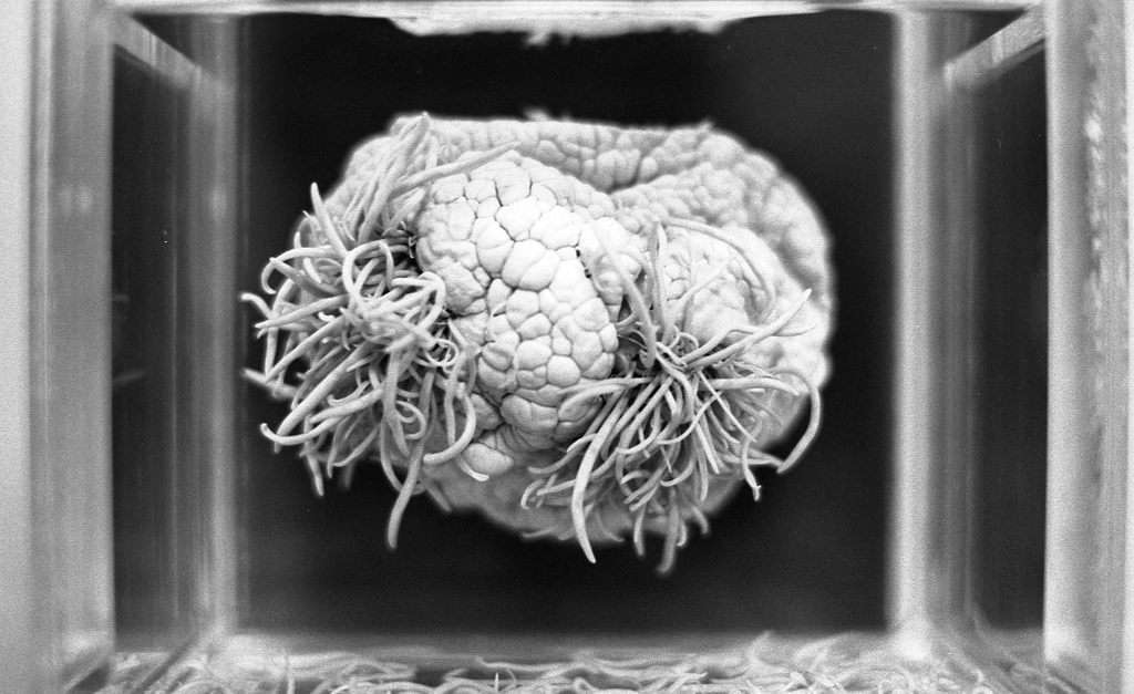 Un cerveau avec son parasite, cliché de Jim Fischer pris au musée Meguro à Tokyo Un cerveau avec son parasite, cliché de Jim Fischer pris au musée Meguro à Tokyo